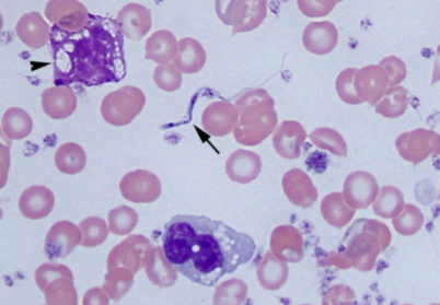 <p><span><span>Causes Chagas disease;</span></span><span style="color: rgb(255, 250, 250);"><span> Highly pathogenic: fever, lethargy, muscle aches, headaches, vomiting, rash, enlarged lymph nodes → chronic cardiac issues, megaesophagus, megacolon</span></span></p>