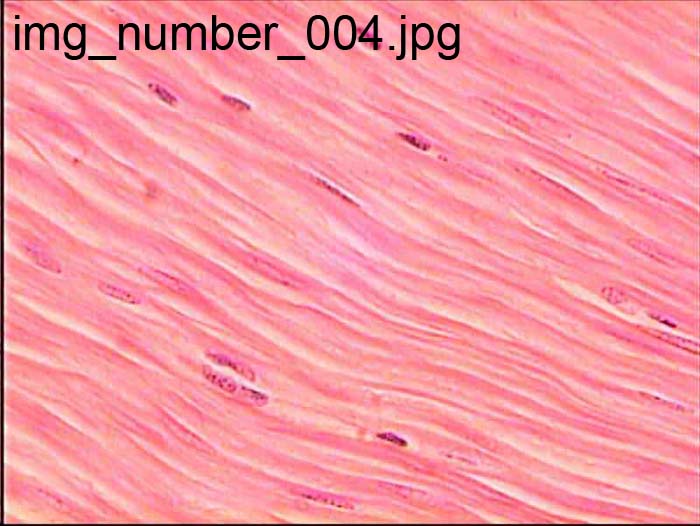 <p>Smooth muscle</p>