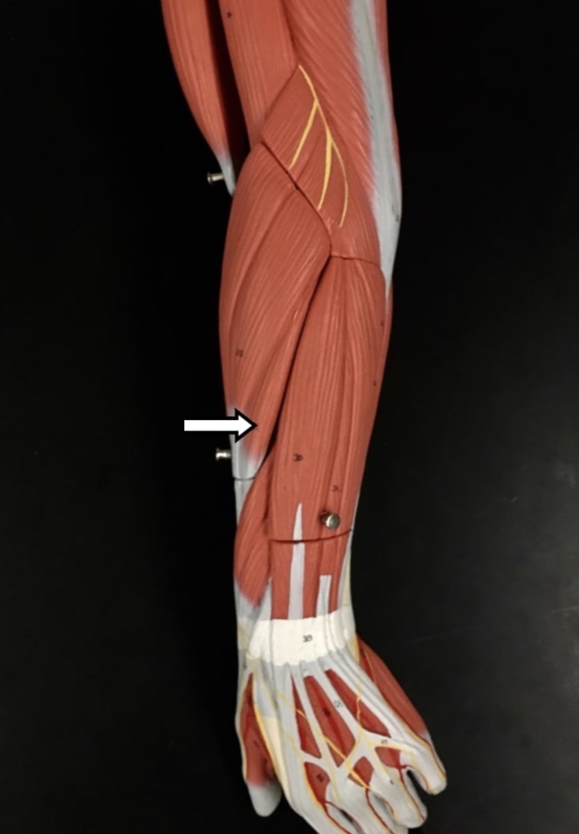 <p><span>Name the muscle labeled with the white arrow below AND name ONE action</span></p>