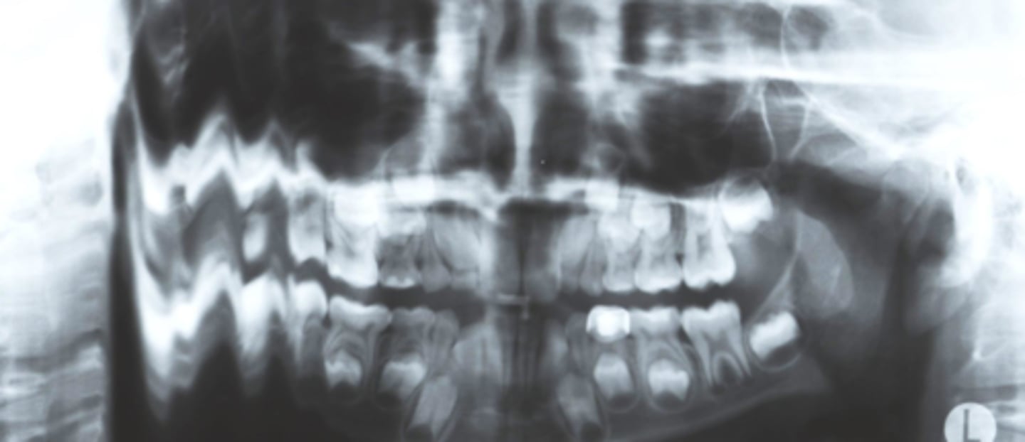 <p>What is the cause of this resultant image?</p>