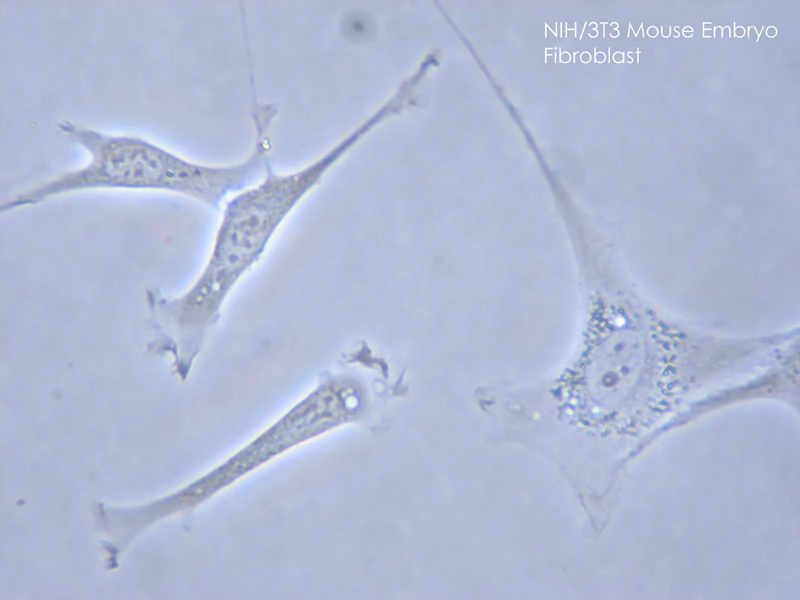 <p>fibroblasts</p>