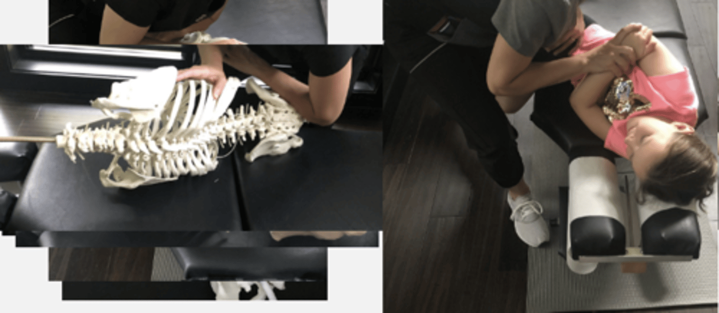 <p>PP: Basic side posture position with the dysfunctional side up - verbalize how you found the segment</p><p>DP: Modified fencer stance on side of dysfunction -naturally becomes more of a chest drop</p><p>CH: Caudal (L) forearm, soft broad contact pull inferior and lateral over the medial, inferior margin of</p><p>IH: Cephalic ( R) hand slight upward traction holding the pt's up-side shoulder or overlapping hand</p><p>LOD: CH: Thrust P-A, along shaft of femur to induce SIJ flexion</p>