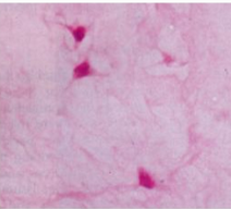 <p>What kind of tissue is this, and where is it located?</p>