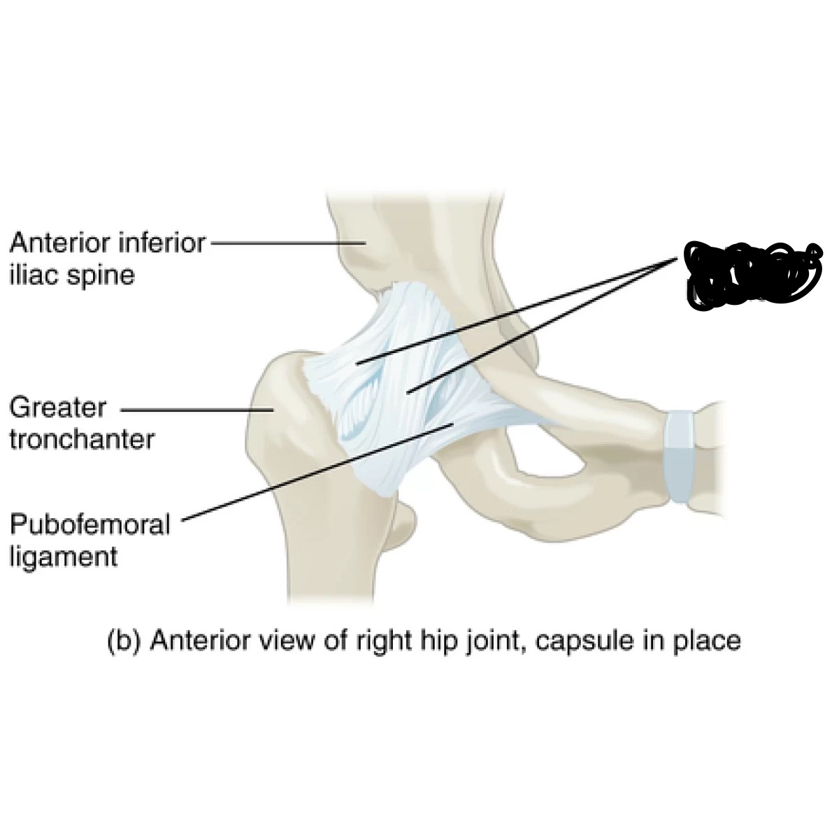 <p>what ligament is crossed out in the picture?</p>