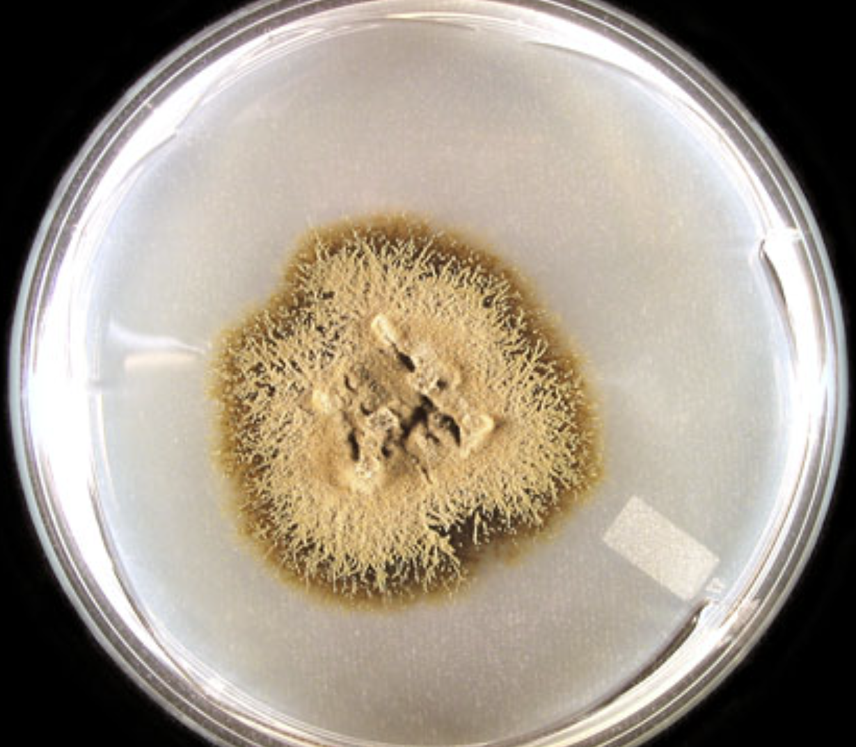 <p>What organism is this? Obverse or reverse?</p>