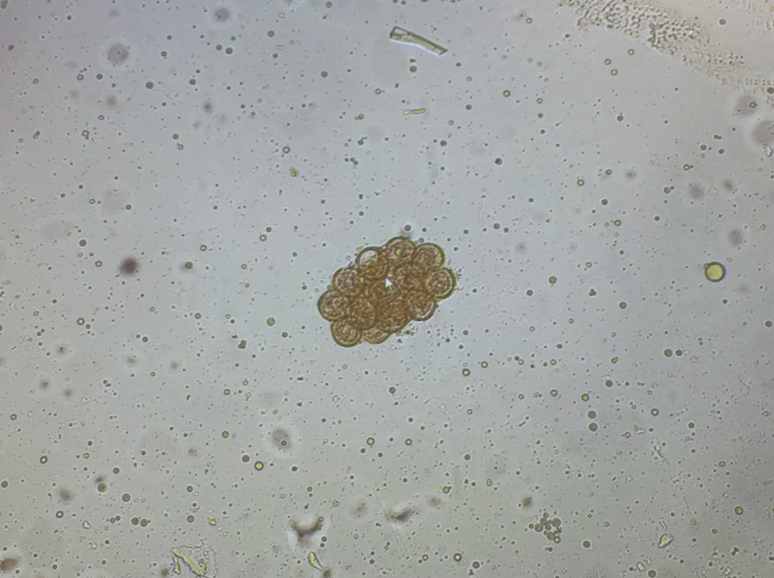 <p>dog/cat ingests flea (or kid)</p>