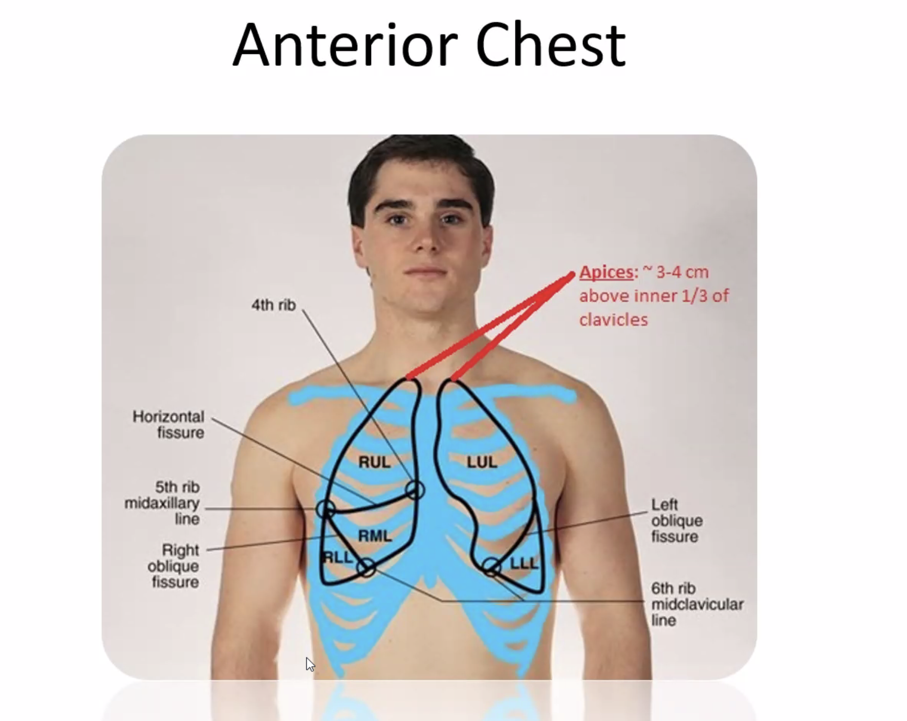 <p>Understand lung anatomy (lobes, landmarks)</p>