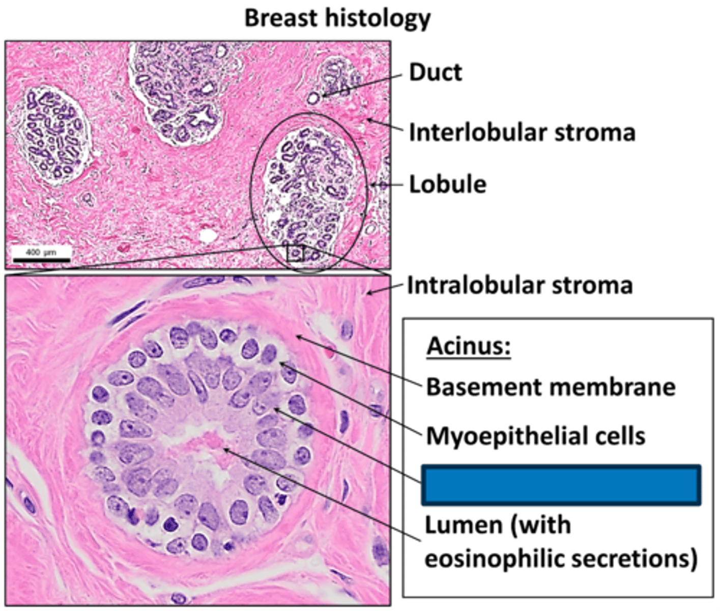 <p>What cells in the INNER cell layer of the lobules of the TDLU produce milk?</p>