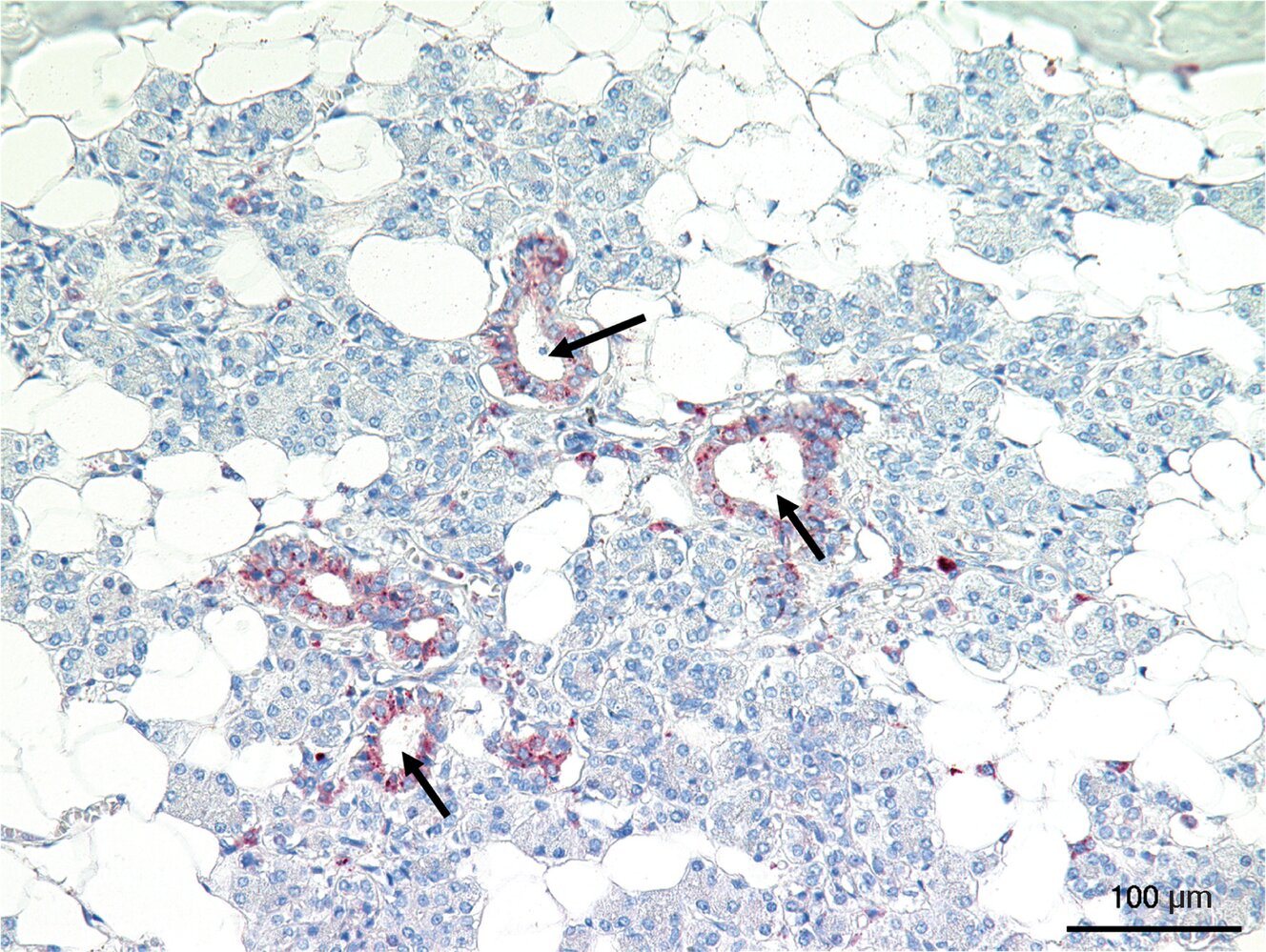 <p>7. The epithelium of the structures marked with arrows in the image:</p><p>A. Has basal striations</p><p>B. Belongs to intercalated ducts</p><p>C. Lines interlobular excretory ducts</p><p>D. Is most commonly found in the sublingual gland</p><p>E. Secretes isotonic saliva</p>