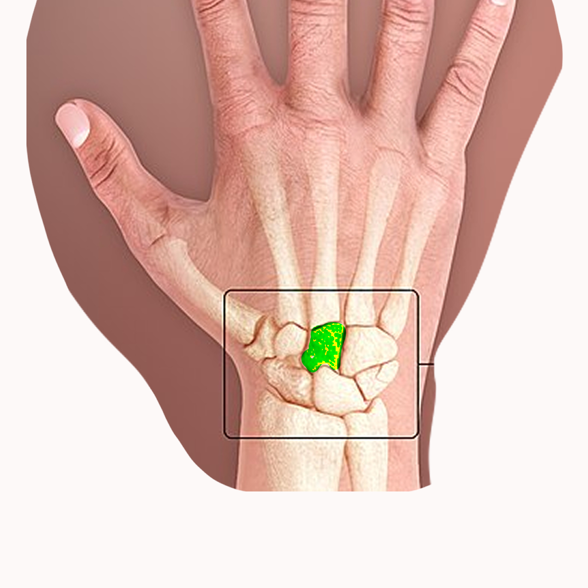 <p>Name the highlighted carpal</p>