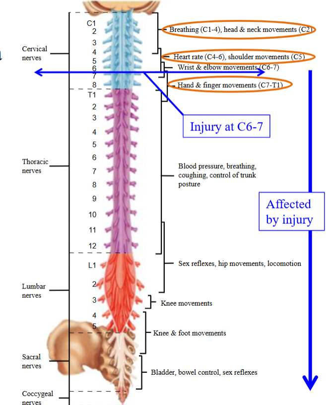 <ul><li><p>When the spinal cord is damaged at a given level, sensation form and the motor control of functions below that level are likely to be abnormal/absent depending on severity. </p></li><li><p>i.e. if spinal cord is damaged at L2, sensation and movements of lower part of leg, bladder, bowel, and sexual functions are affected, but not breathing, trunk posture, etc.</p><ul><li><p>Called paraplegia.</p></li></ul></li></ul><p></p>