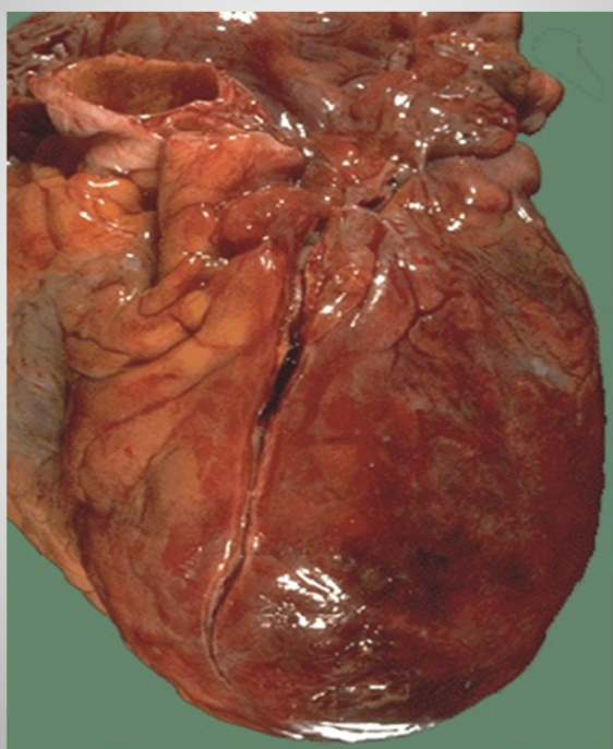 <p>Acute Disease</p>