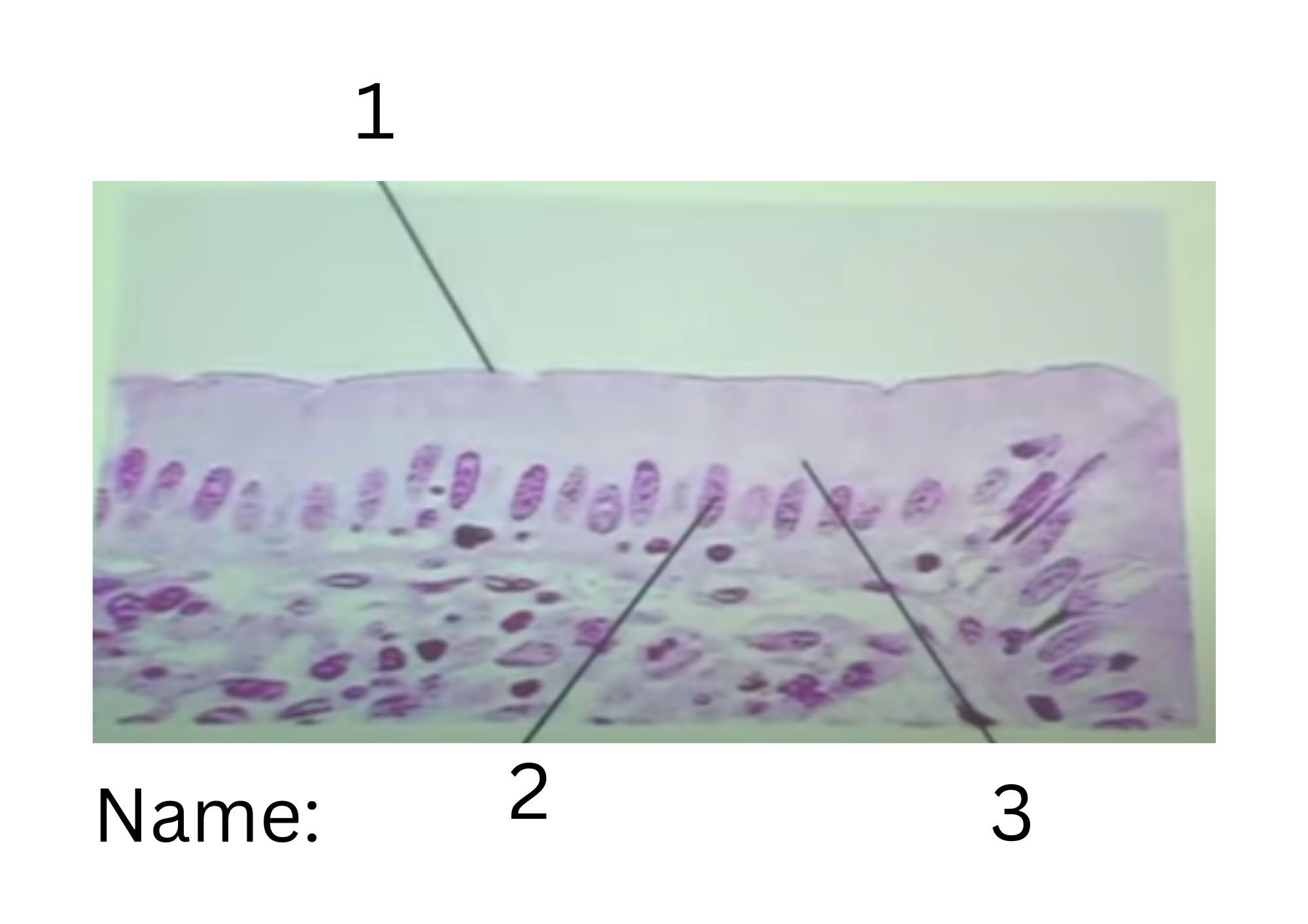 term image