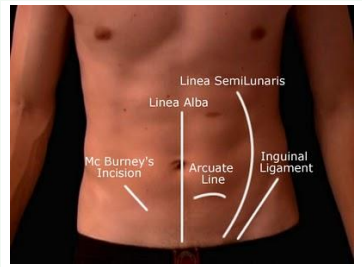 <p><strong>Linea alba</strong> is considered a “white zone” because there’s no blood supply nor nerve tissue</p>