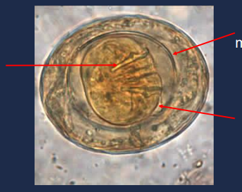 State the name of the lower right portion of the picture.