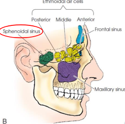 <ul><li><p>normally paired</p></li><li><p>occupy body of sphenoid bone</p></li><li><p>often only one sinus develops, but never more than two</p></li><li><p>vary in size and shape</p></li><li><p>usually asymmetric</p></li><li><p>located below sella turcica and extend between dorsume and posterior ethmoids</p></li></ul><p></p>