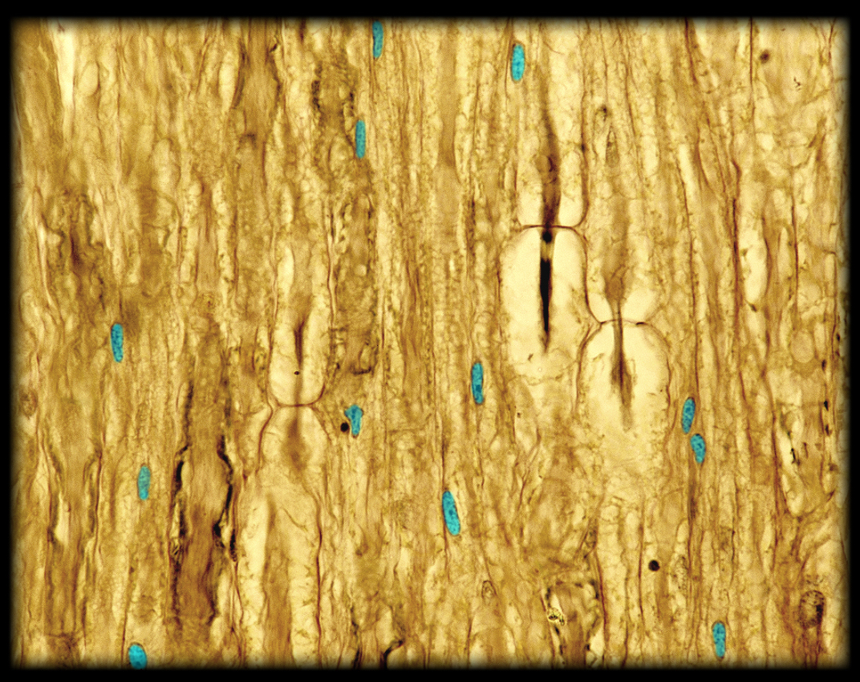 <h4 collapsed="false" seolevelmigrated="true"><strong>Location:</strong></h4><ul><li><p>Soma (cell body) of Schwann cell</p></li></ul><h4 collapsed="false" seolevelmigrated="true"><strong>Description:</strong></h4><ul><li><p>Largest organelle (5-10 µm in diameter)</p></li><li><p>Spherical or ovoid structure</p></li><li><p>Nuclear envelope comprised of double membrane (i.e., two lipid bilayers)</p></li><li><p>Contains cellular DNA and nucleolus</p></li></ul><h4 collapsed="false" seolevelmigrated="true"><strong>Function:</strong></h4><ul><li><p>DNA replication</p></li><li><p>DNA transcription into mRNA</p></li><li><p>Ribosomal RNA synthesis and ribosome subunit assembly (in nucleolus)</p></li></ul><h4 collapsed="false" seolevelmigrated="true"><strong>Comment:</strong></h4><ul><li><p>Staining of DNA with basic histological dyes like hematoxylin depends on transcriptional activity: DNA undergoing active transcription, called euchromatin, stains lightly because it is less folded and, therefore, less dense; transcriptionally inactive DNA, or heterochromatin, is tightly packed and condensed and, therefore, stains more darkly</p></li><li><p>Micrometer (µm), also known as a micron, is 1/1,000 of a millimeter</p></li></ul>
