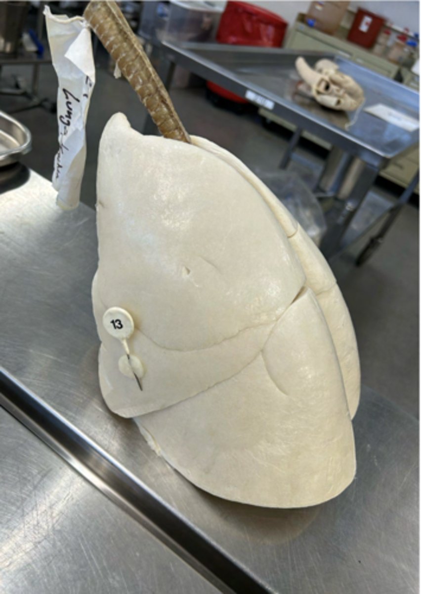<p>What lymph node do efferent vessels from this specific lobe typically drain into</p><p>first?</p>