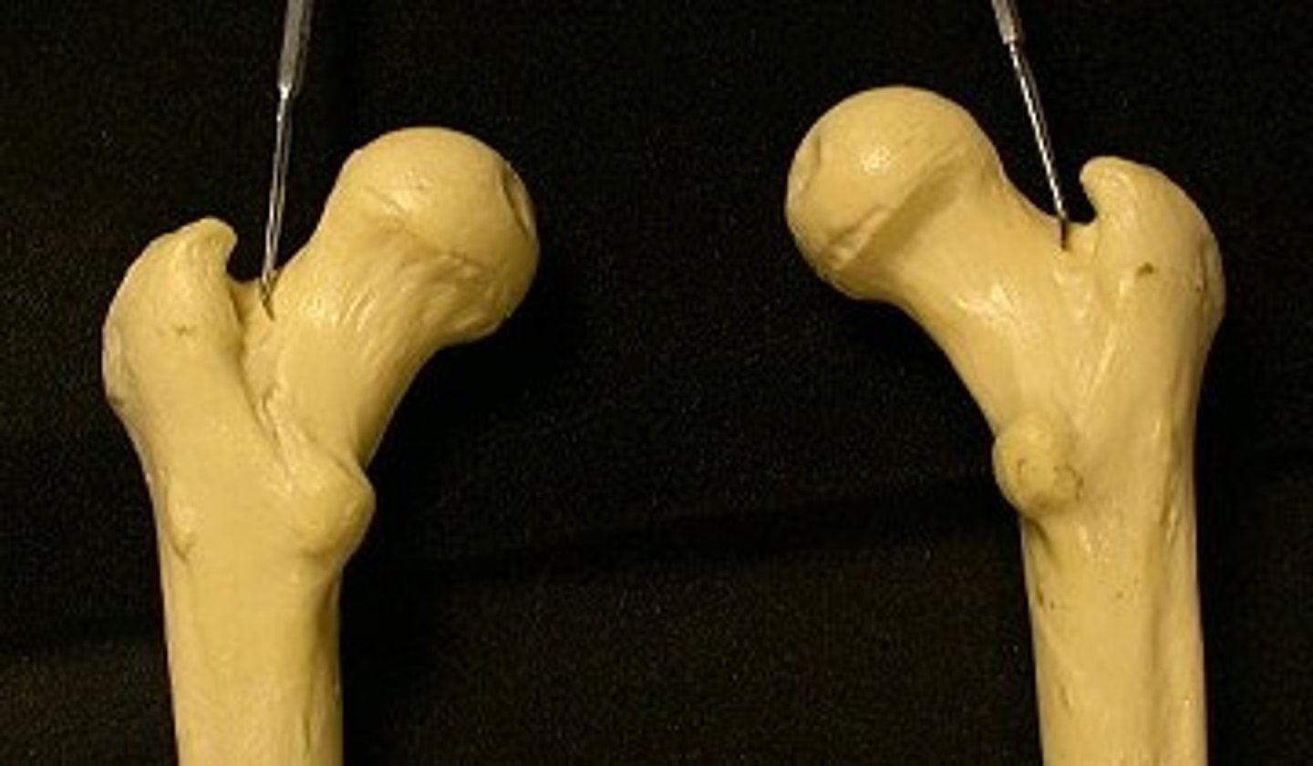 <p>depression on medial surface of greater trochanter</p>