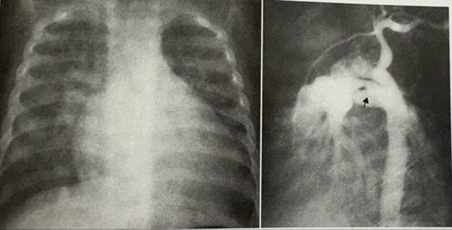 <p>what pathology is present?</p>