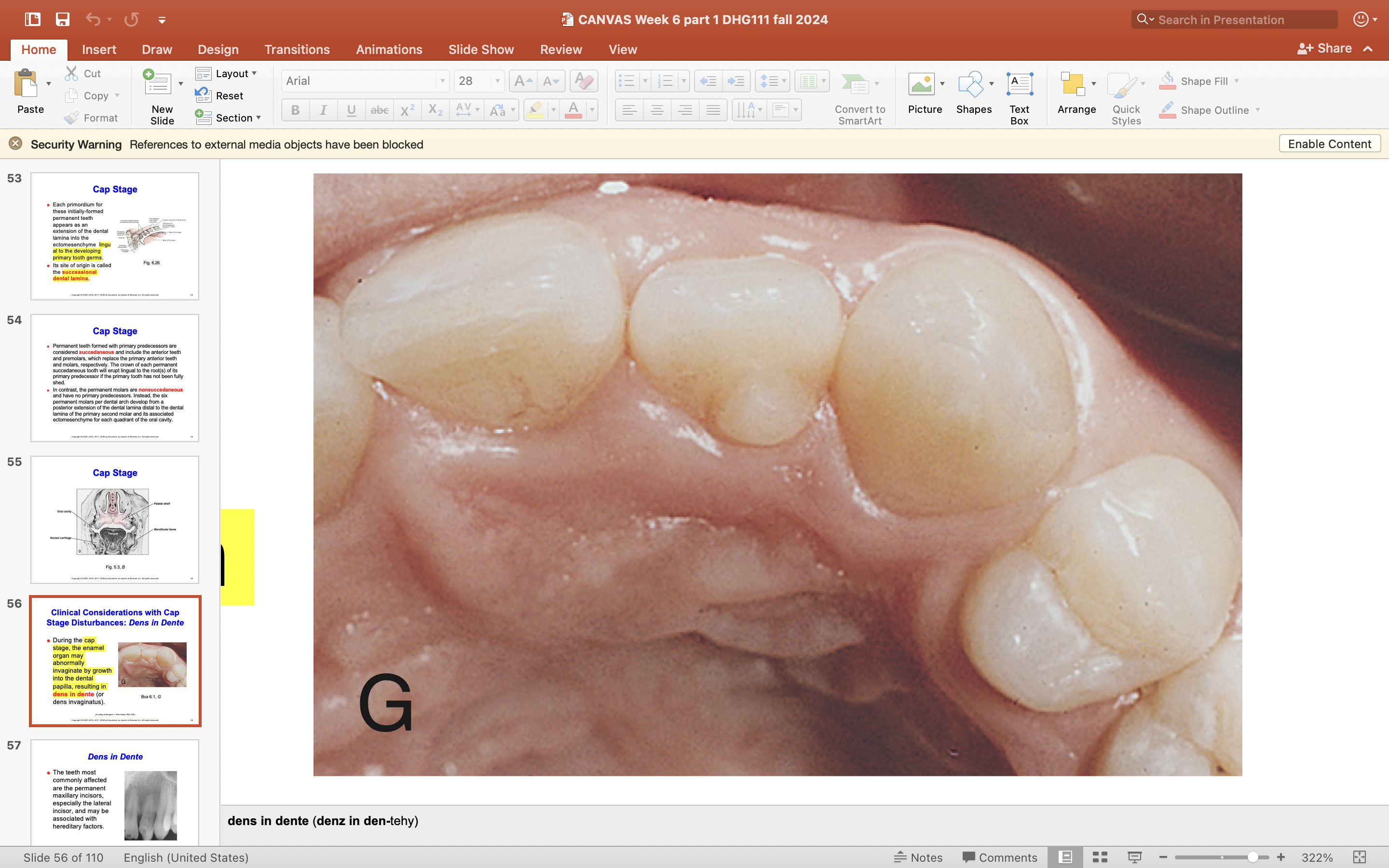 <p>During the cap stage, the enamel organ may abnormally grow inward into the <strong>dental papilla,</strong> causing a condition called dens in dente (or veins invaginatus). </p>