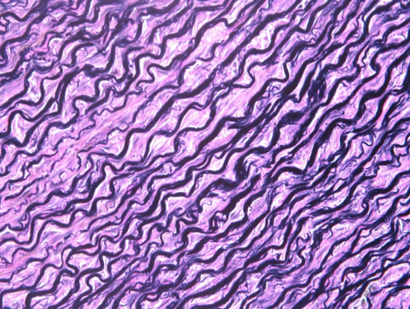 <p>What kind of fibers are these? (multiple wavy lines running parallel to each other)</p><p>A. Collagen</p><p>B. Elastic</p><p>C. Reticular</p><p>D. Polyester</p>