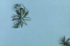 <p>Name this drug associated crystal? what is it associated with? </p>