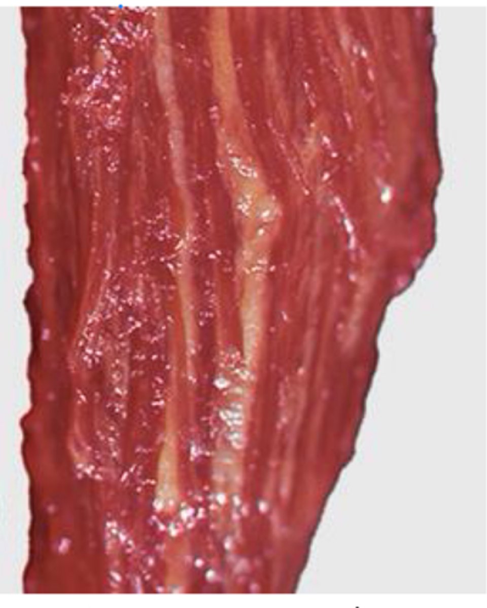 <p>What pathological changes can we see in equine motor neuron dz?</p>