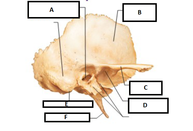 <p>D. Which temporal bone marking is this? (2)</p>