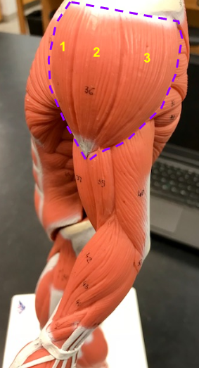 <p>What is the structure outlined in purple? Origin? Insert?</p>