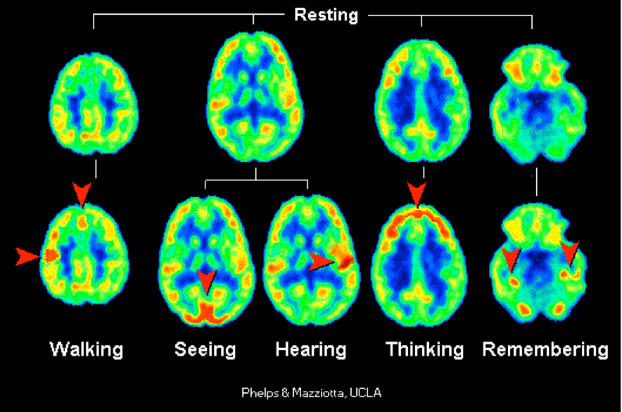 <p>Displays brain activity by detecting radioactive glucose</p>