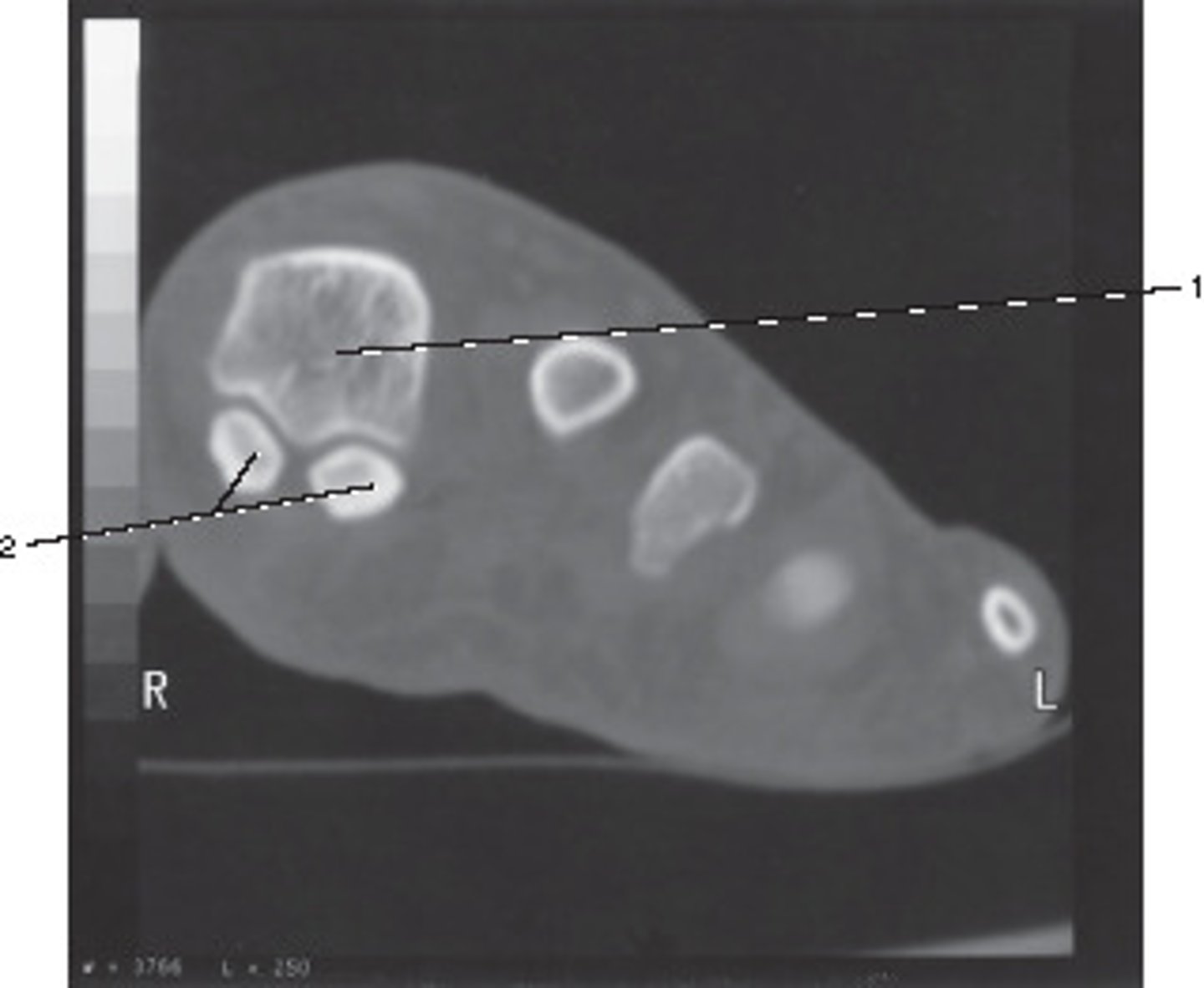 <p>Number 2 corresponds to which of the following?</p>