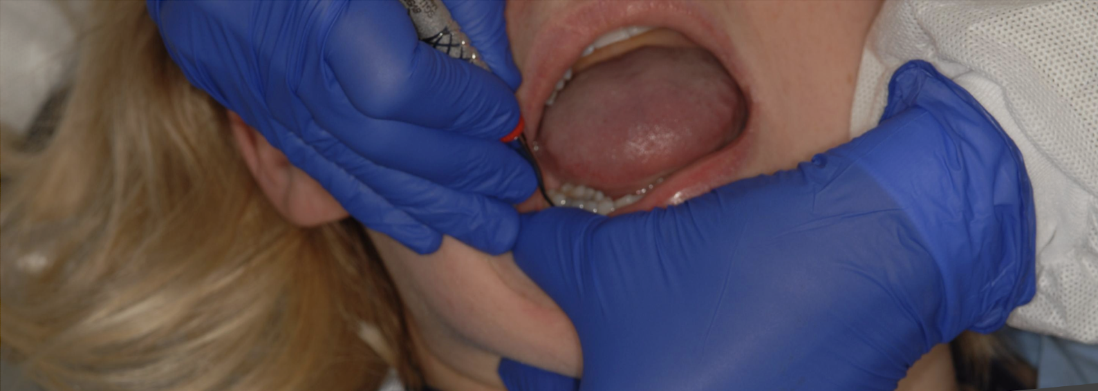 <p>what fulcrum is this </p>