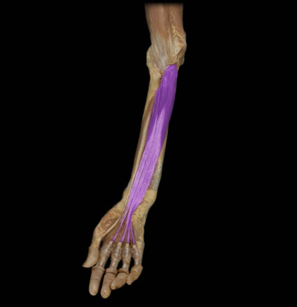 <p><em>table 1, median nerve (digits 2-3), ulnar nerve (digits 4-5); DIP flexion digits 2-5</em><br><em>lies deep to the superficial flexors</em></p>