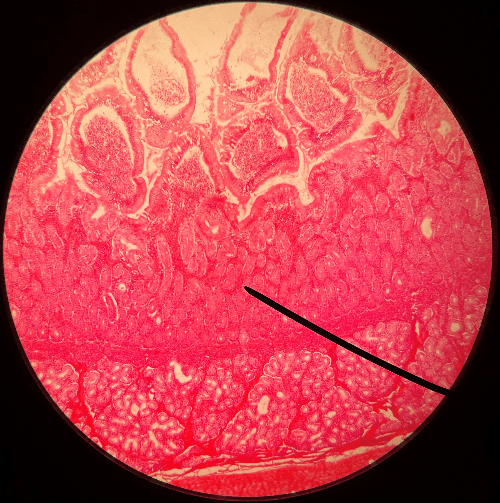 • Slide histology of the duodenum.

• Located in the mucosa layer of the duodenum.

• Produces hormones that participate in digestion.
