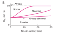 <p><span>→ L’oxygène diffuse </span><strong>moins vite à travers la membrane aléolo-capillaire</strong><span>, car le gradient de pression (P1 - P2 dans l’équation de Fick) est plus faible et le débit diminue aussi.</span></p>