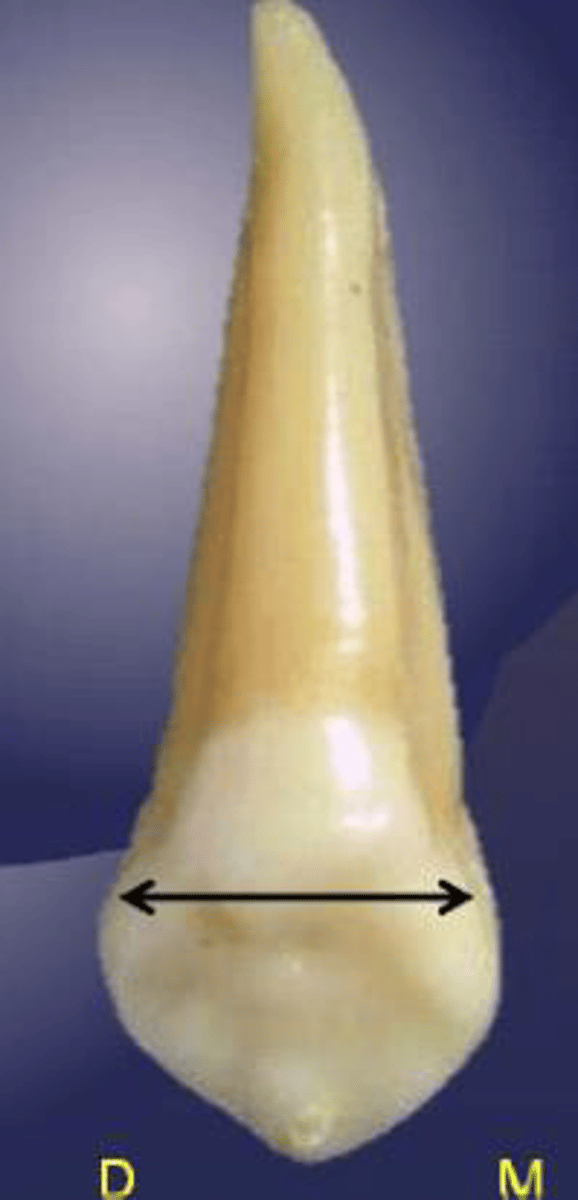 <p>what tooth is this?</p>