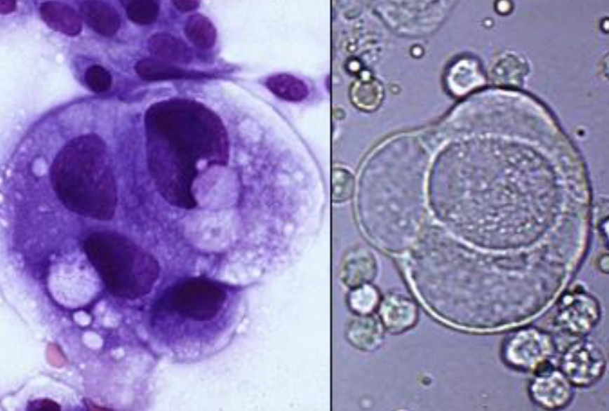 <p>If you made a line smear and saw this, what would be your first thought?</p><p>What are the dark purple dots in the cell?</p><p></p>