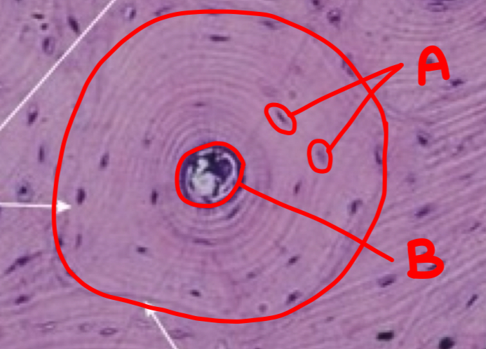 <p>what type of bone is depicted and what is inside the circle</p>