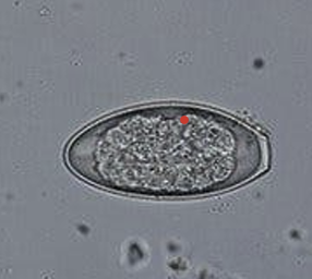 <p>flattened on one side, convex on the other</p><p>operculum on one end</p><p>may be embryonated</p>