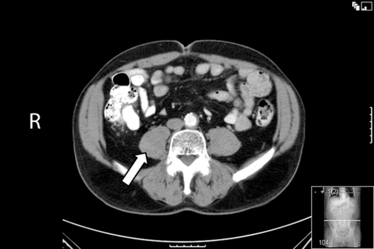 <p>What is indicated in the image?</p>