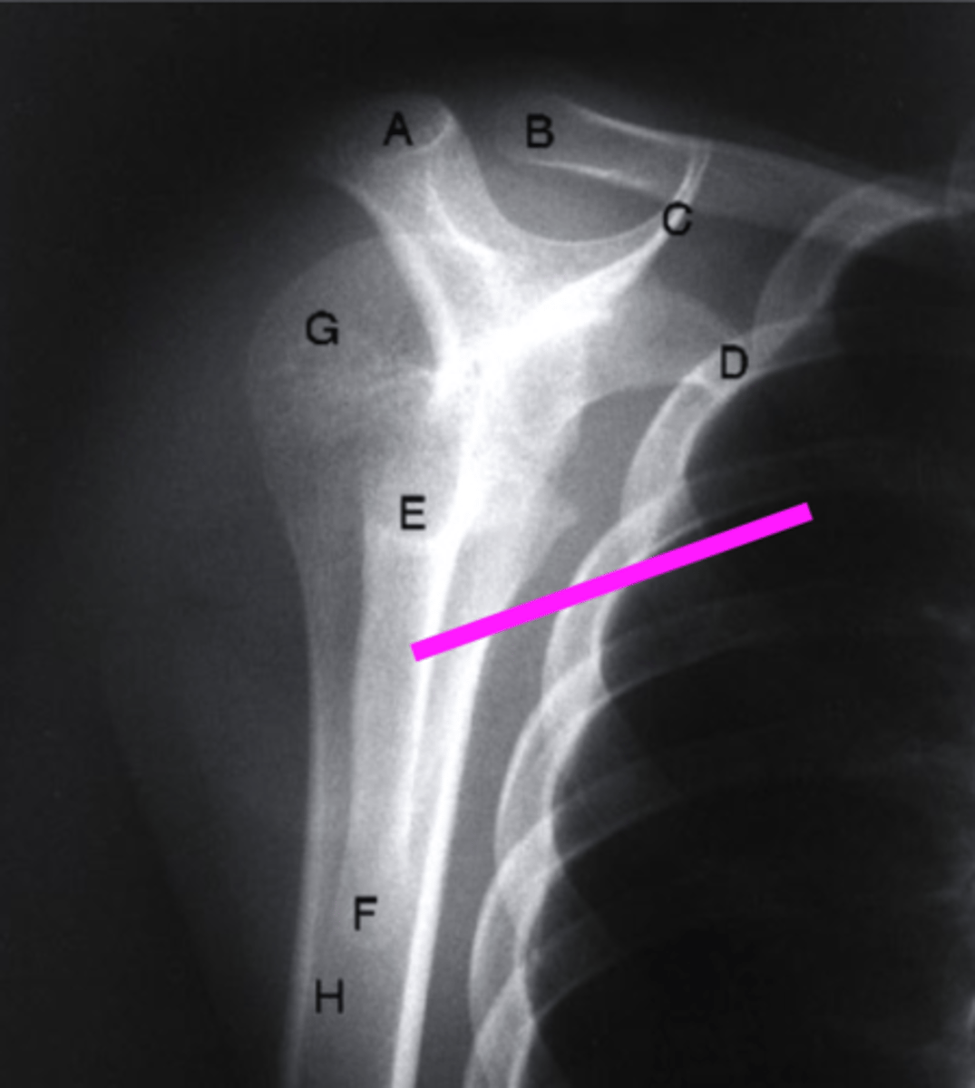 <p>what does the pink line point to?</p>