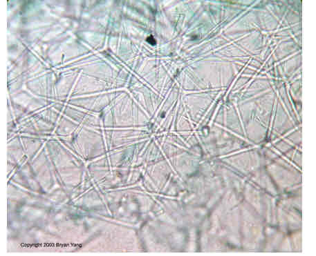 <p>Spicules</p>
