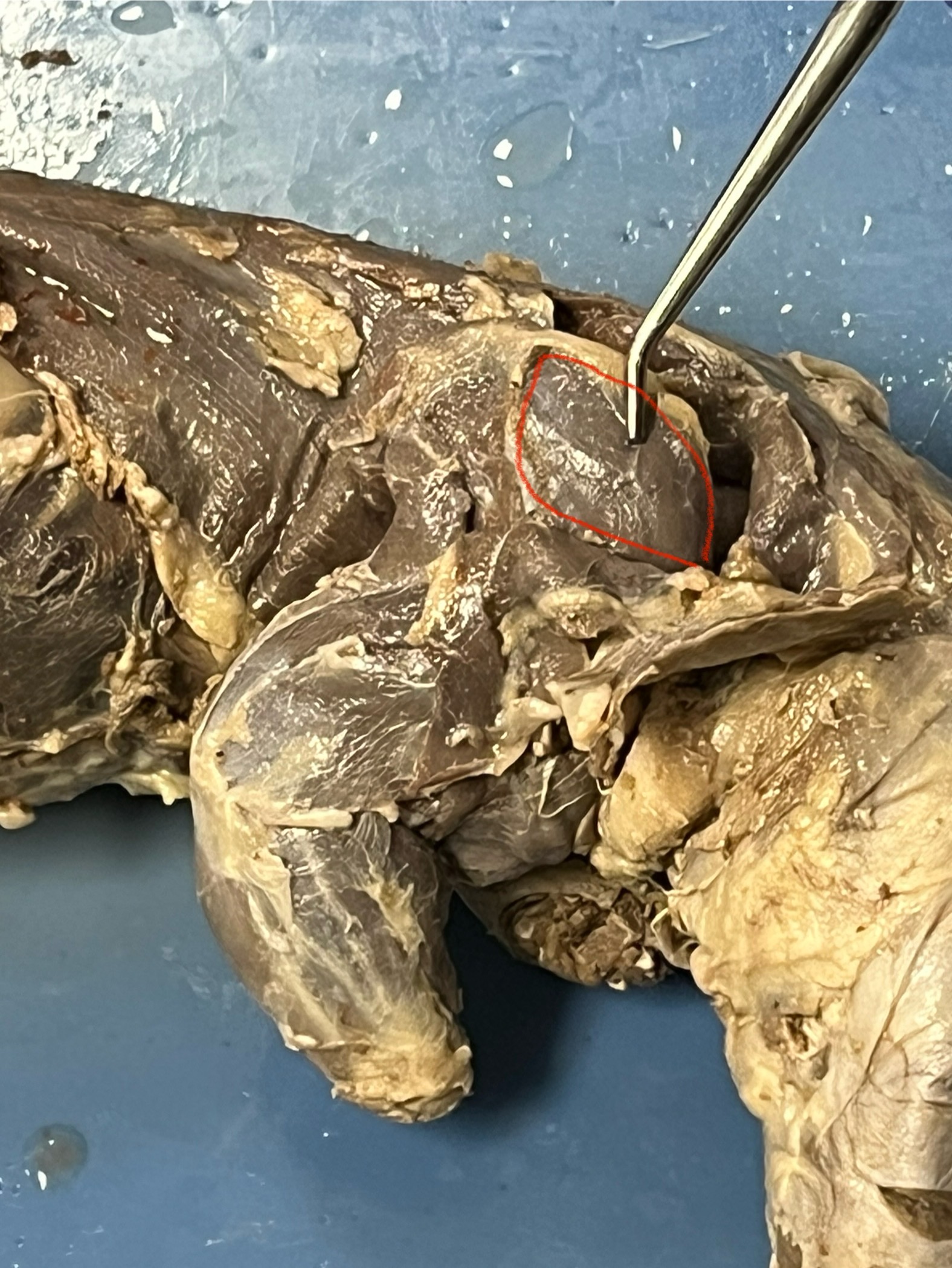term image