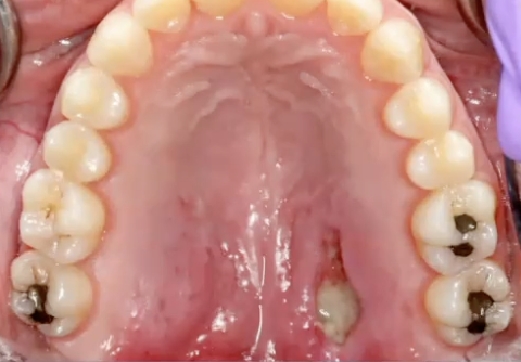 <p>What is the diagnosis?</p>