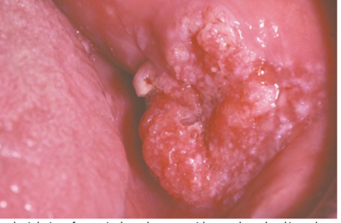 <p>Hint: Varied clinical presentation</p>