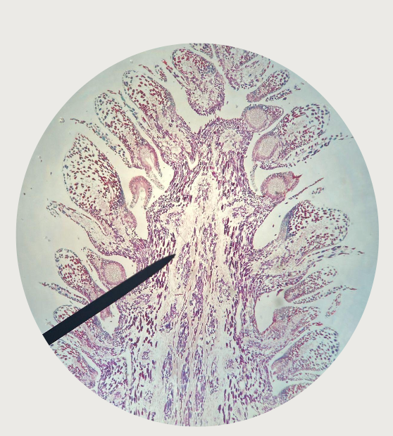 term image