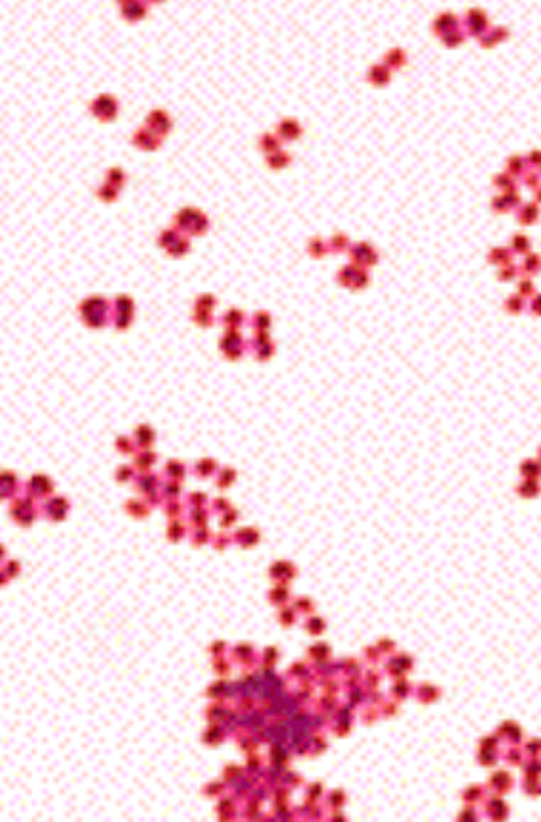 <p>coccus or rods?</p><p>G+ or G-?</p>