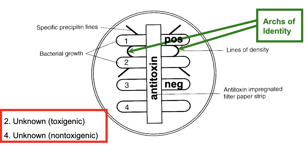 <p>detects diptheria toxin based on principle of immunodiffusion. heavy inoculum of test organism (controls &amp; unknowns) is streaked onto plated medium in a single line. antitoxin impregnated in strip of sterile filter paper on agar. incubate for 24 hours. if organism is toxigenic, visible line of Ag-Ab precipitate will form</p>