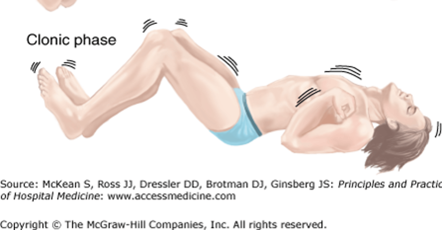 <p>jerking</p><p>sustained muscle contraction w/ alternation of relaxation</p>